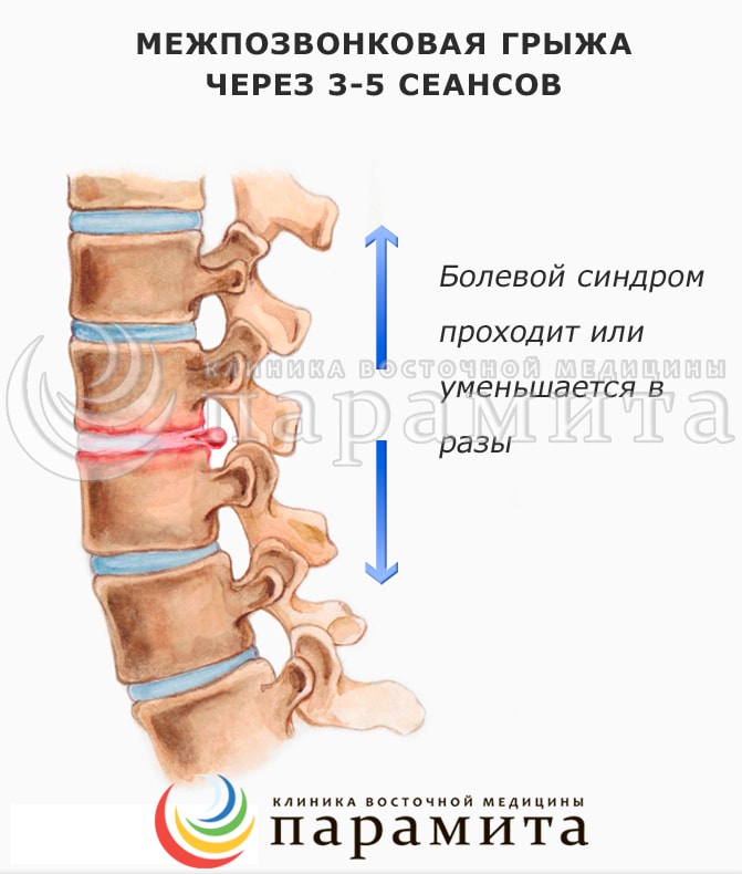 Боль в суставах и что сделать чтобы ее не было - Ваш домашний Боль в локтевом суставе: причины, симптомы и правильное лечение